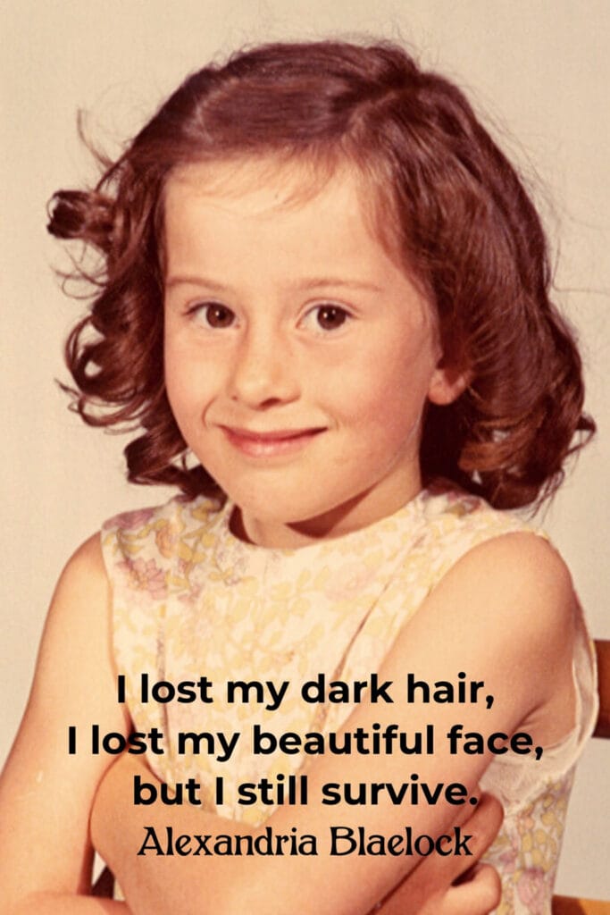 a picture of the author as a child and the haiku "I lost my dark hair, I lost my beautiful face, but I still survive.